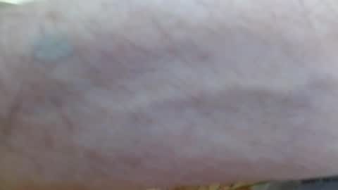 mrtease5 online show from 03/25/26, 07:31