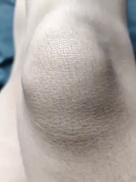 Miky Lyn online show from 02/18/26, 05:53